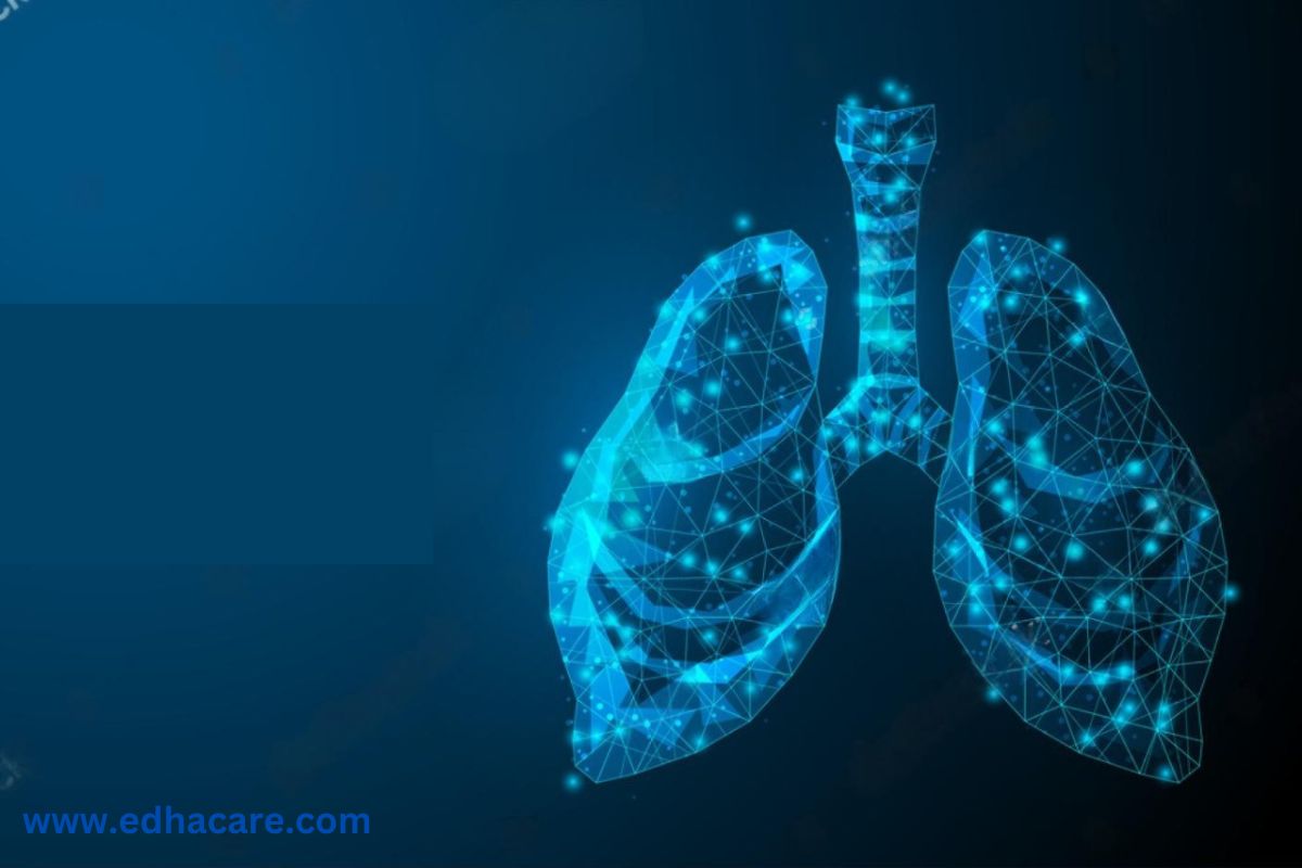 Lung Transplant Cost In India - Surgery, Cost, Procedure