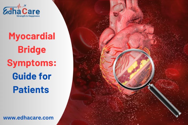 Myocardial Bridge Symptoms: Causes, Diagnosis, and Treatment