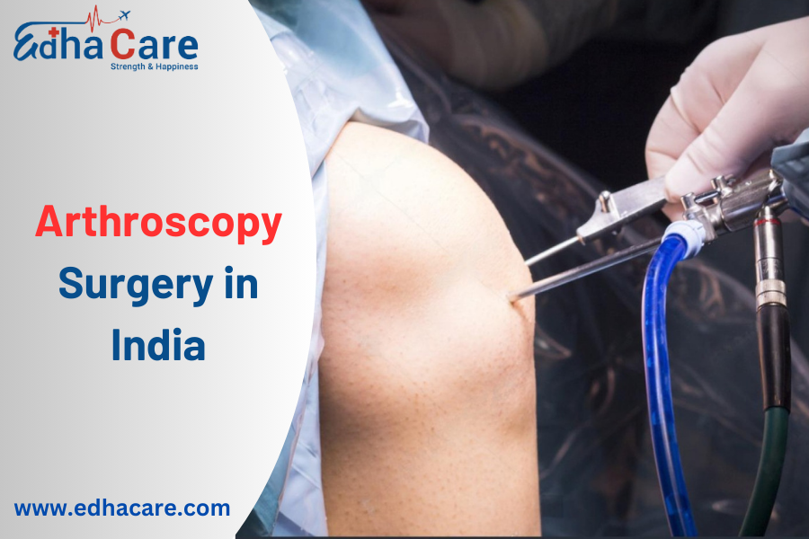 Arthroscopy Surgery in India: A Comprehensive Guide