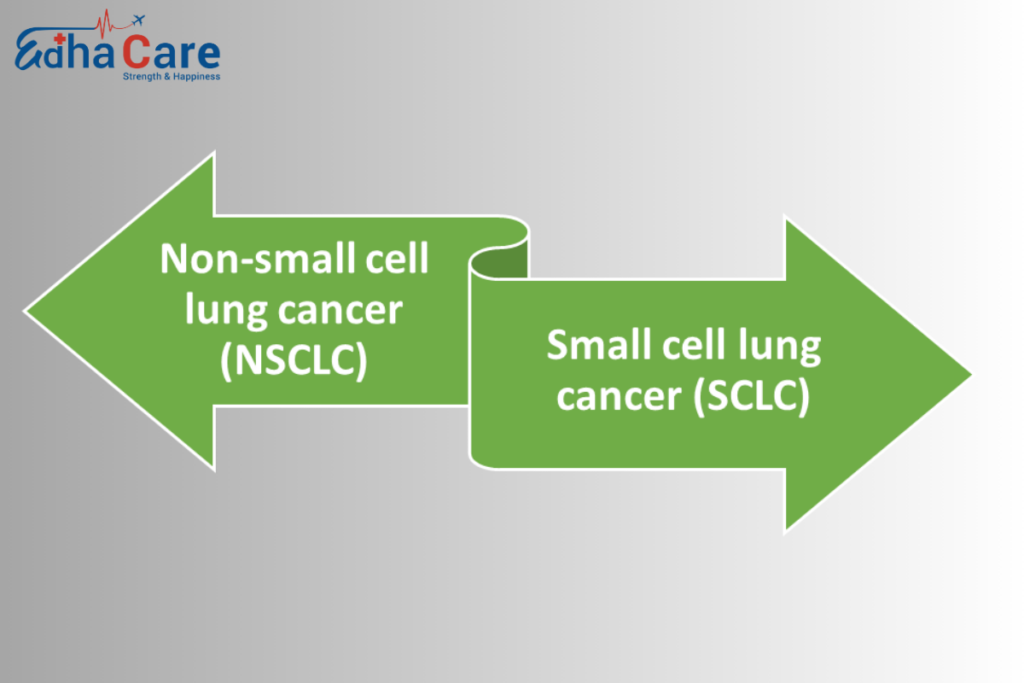 Types of Lung Cancer