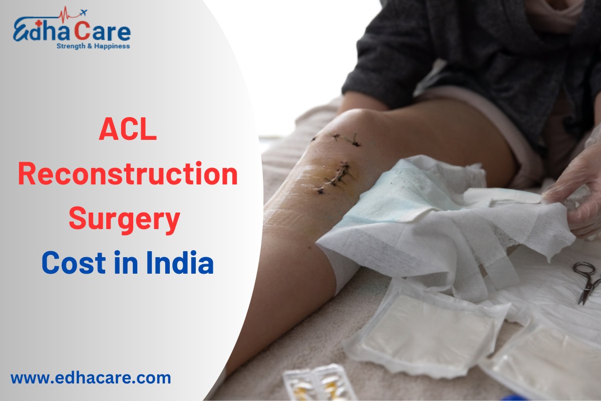 ACL Reconstruction Surgery Cost in India