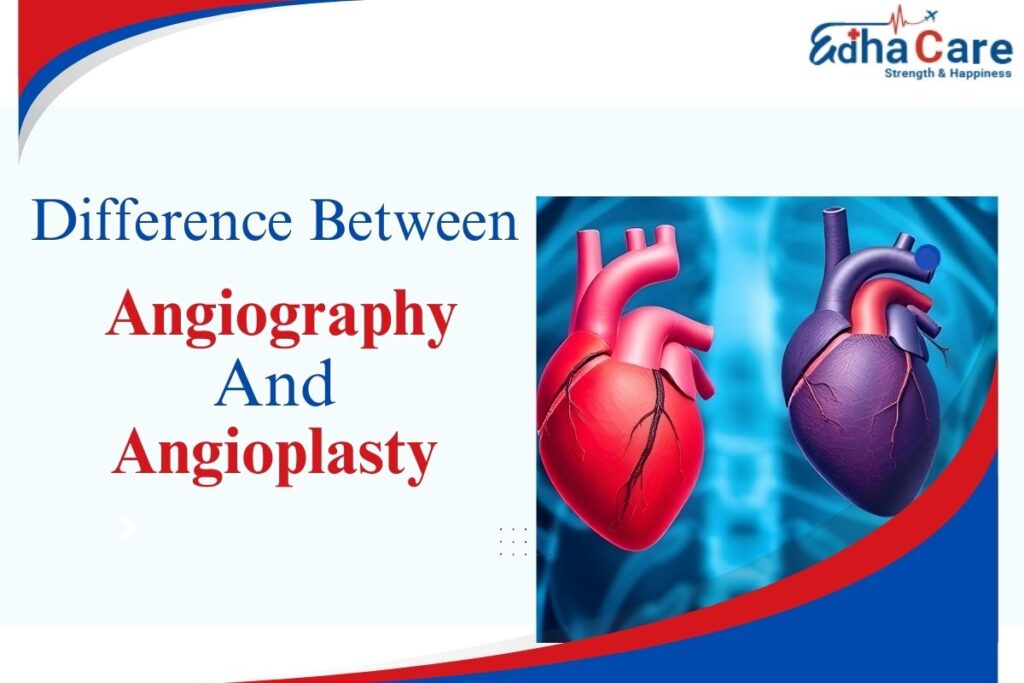 Difference Between Angiography and Angioplasty