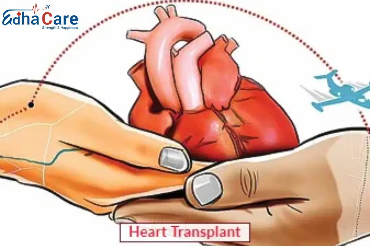 Операция по пересадке сердца | Пересадка сердца | EdhaCare